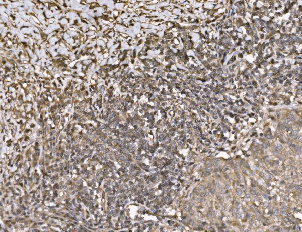 a03979 1 kif2a primary antibodies ihc testing 2