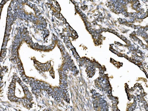 a03979 1 kif2a primary antibodies ihc testing 3
