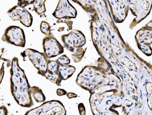 a03979 1 kif2a primary antibodies ihc testing 4