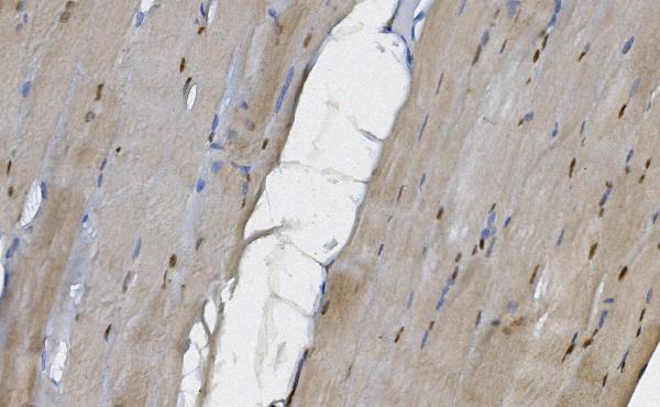 a03980 3 map2k5 primary antibodies ihc testing 2