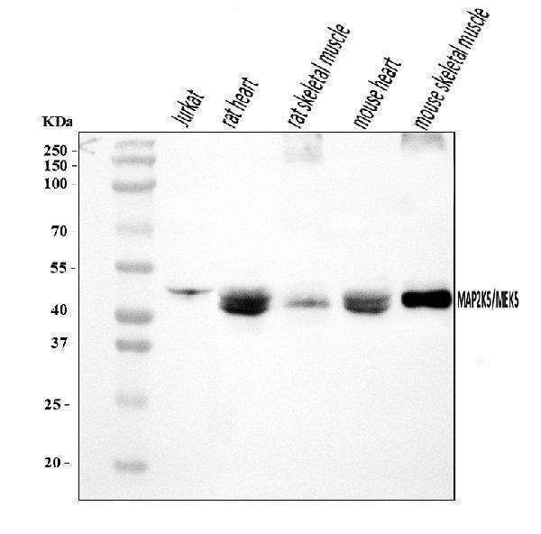  Western blot analysis of MEK5/MAP2K5 using anti-MEK5/MAP2K5 antibody (A03980-4)