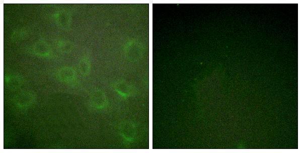Immunofluorescence analysis of HUVEC cells, using Kv1