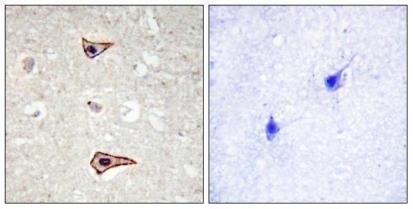 Immunohistochemistry analysis of paraffin-embedded human brain, using Kv1