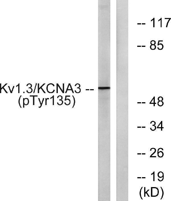 Western blot analysis of lysates from Jurkat cells treated with starved 24h, using Kv1
