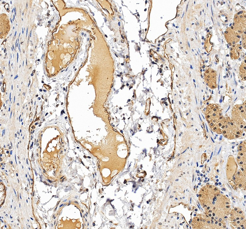 IHC analysis of IGFALS using anti-IGFALS antibody (A03982-1)