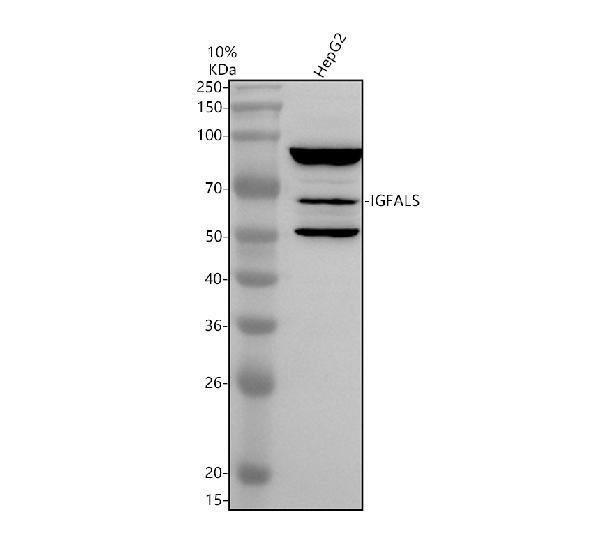 Western blot analysis of IGFALS using anti-IGFALS antibody (A03982-1)