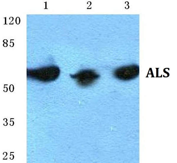 Western blot (WB) analysis of ALS polyclonal antibody at 1:500 dilution
Lane1:HEK293T cell lysate
Lane2:Mouse liver tissue lysate
Lane3:Rat kidney tissue lysate
