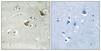 a03985 cckar primary antibodies ihc testing 1