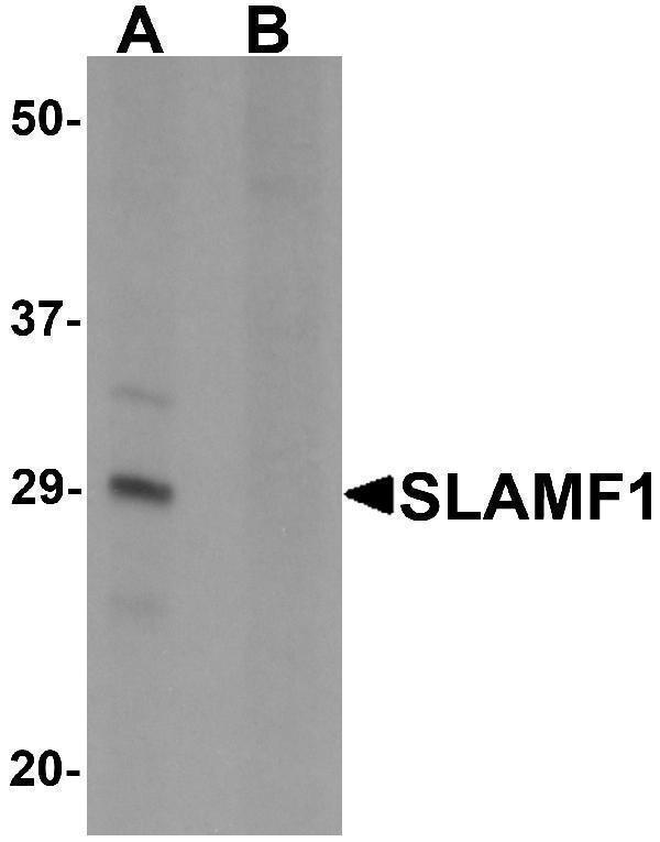 Western blot analysis of SLAMF1 in rat colon tissue lysate with SLAMF1 antibody at 1 μg/mL in (A) the absence and (B) the presence of blocking peptide