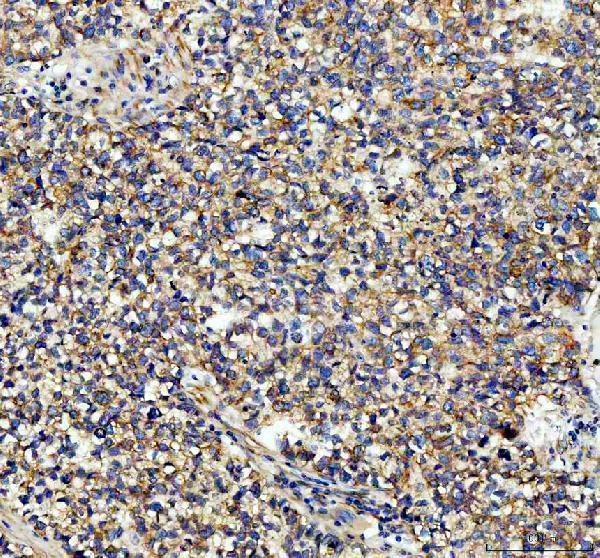 a03989 2 tubulin alpha primary antibodies ihc testing 2