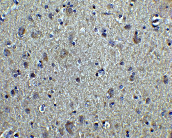 a03989 tuba1a primary antibodies ihc testing 2