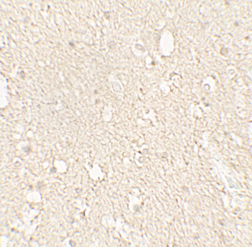a03989 tuba1a primary antibodies ihc testing 4