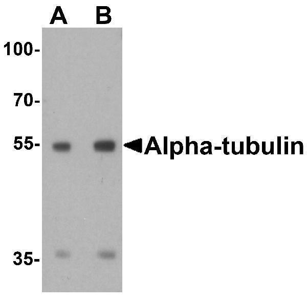 a03989 tuba1a primary antibodies wb testing 1