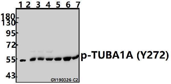 a03989y272 tuba1a primary antiboties wb testing 1
