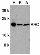 a03991 nol3 primary antibodies wb testing 1