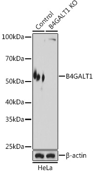 a03993 1 b4galt1 primary antiboties wb testing 1
