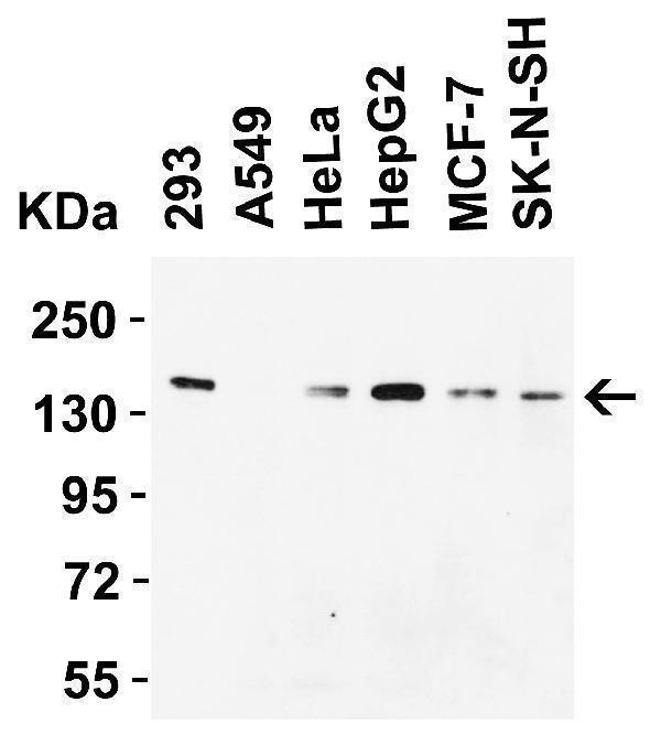 a03994 1 kdm3a primary antibodies wb testing 1