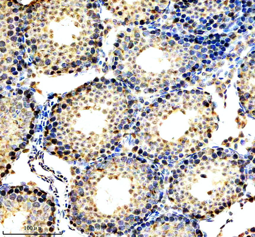 IHC analysis of JMJD1A using anti-JMJD1A antibody (A03994-2)