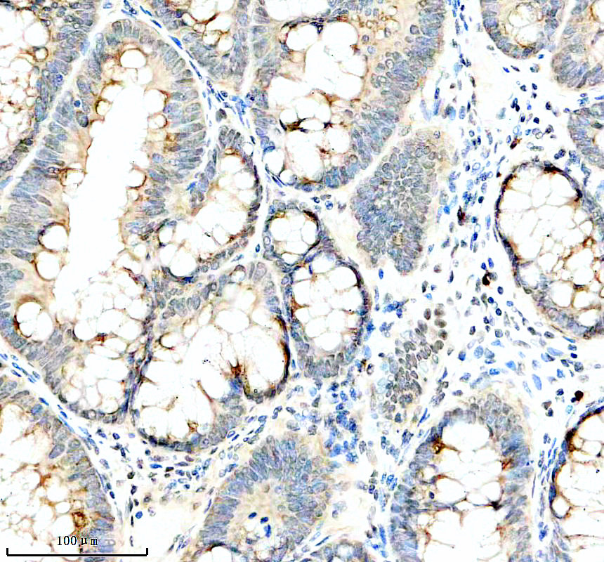a03994 2 jmjd1a primary antibodies ihc testing 3