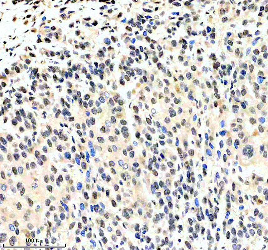 a03994 2 jmjd1a primary antibodies ihc testing 4