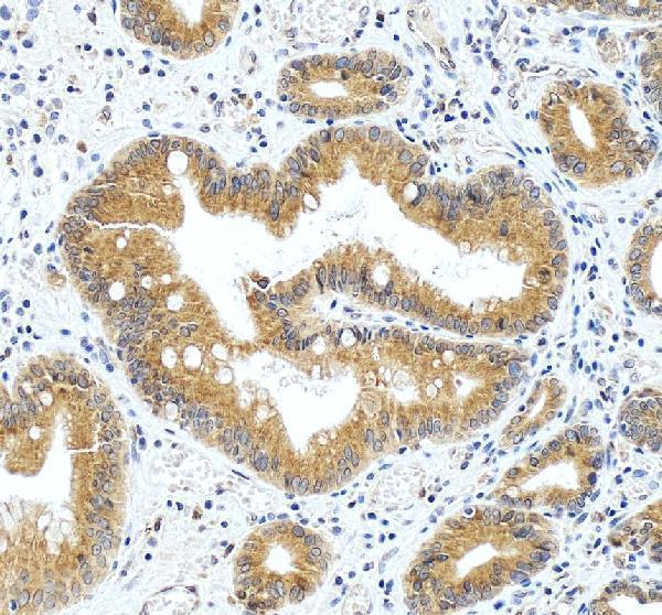 a03994 2 kdm3a primary antibodies ihc testing 1