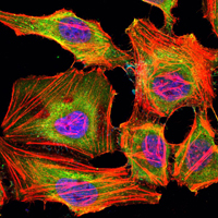 a03994 kdm3a primary antibodies if testing 1