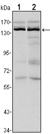 a03994 kdm3a primary antibodies wb testing 2
