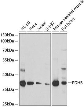 a03998 pdhb primary antiboties wb testing 1