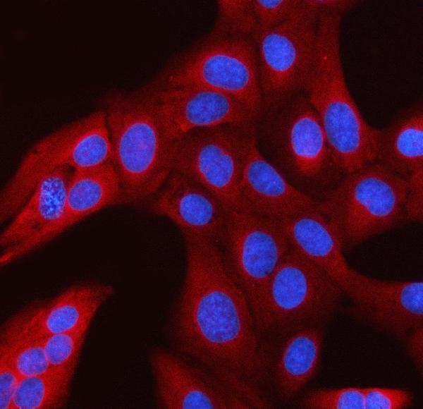  IF analysis of RANBP1 using anti-RANBP1 antibody (A04000-3)