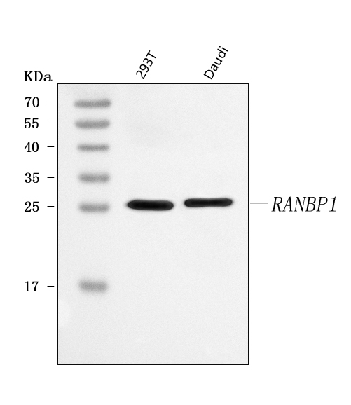  Western blot analysis of RANBP1 using anti-RANBP1 antibody (A04000-3)