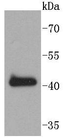 a04004 1 sox18 primary antiboties wb testing 1