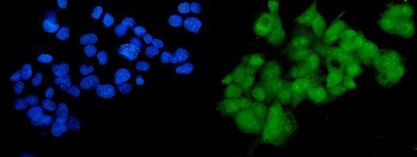 a04004 2 sox18 primary antibodies if testing 2