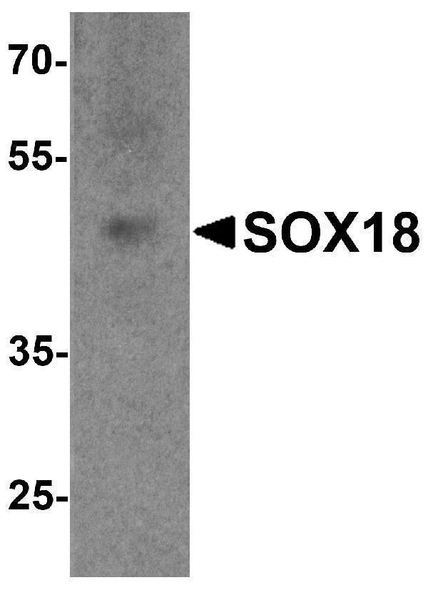 Western blot analysis of SOX18 in 3T3 cell lysate with SOX18 antibody at 1 μg/ml