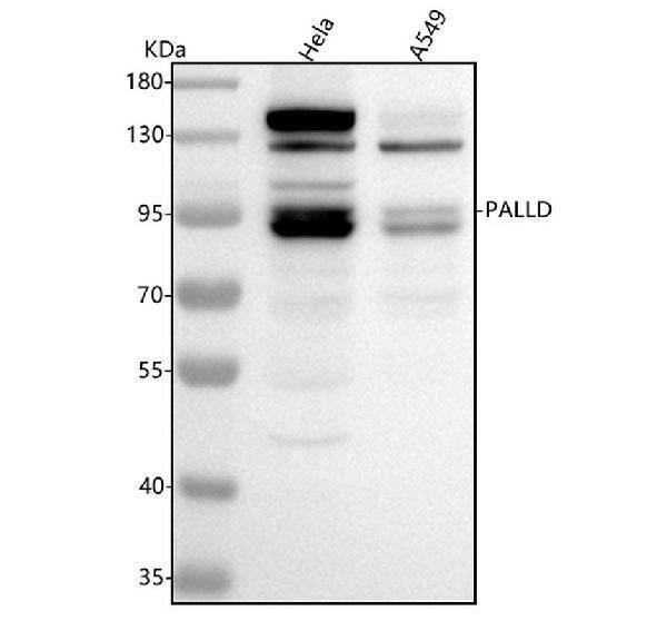  Western blot analysis of Palladin/PALLD using anti-Palladin/PALLD antibody (A04005-3)