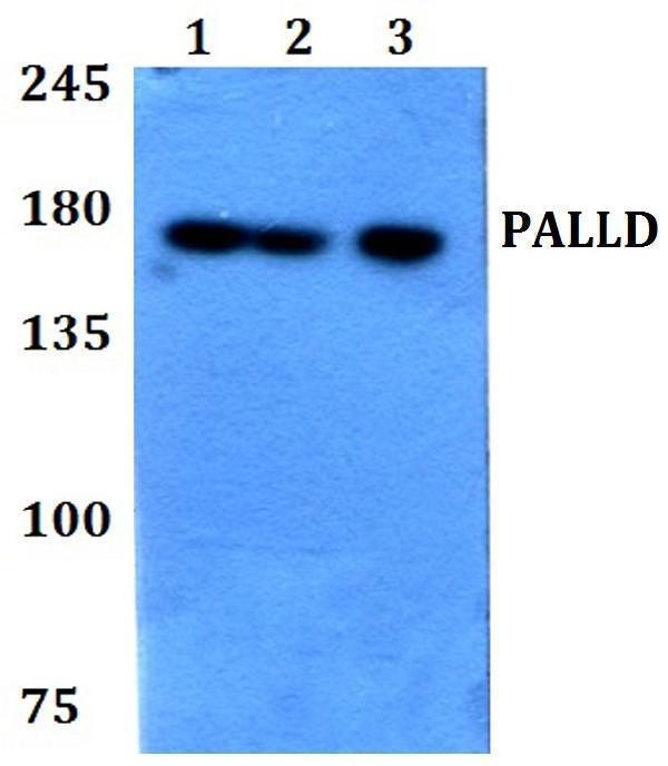 a04005 palld primary antiboties wb testing 1