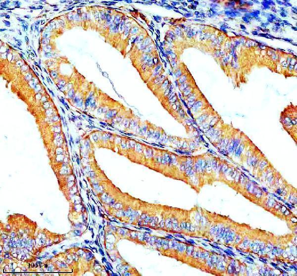 IHC analysis of ZIP8/SLC39A8 using anti-ZIP8/SLC39A8 antibody (A04007-1)
