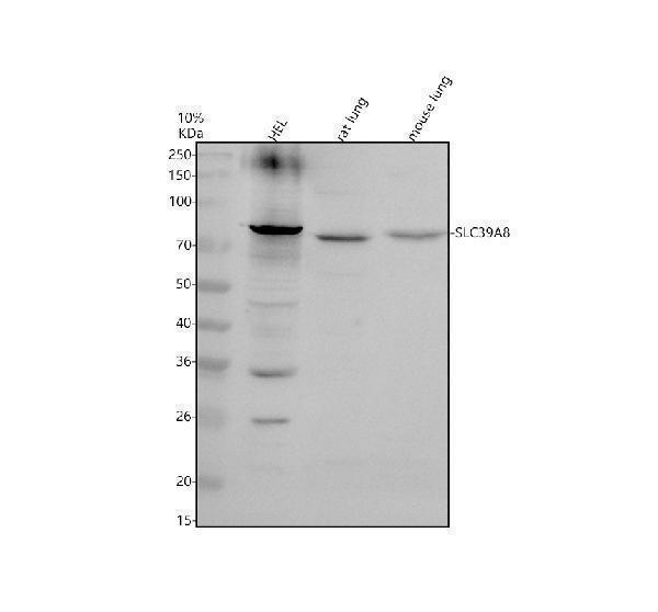 Western blot analysis of ZIP8/SLC39A8 using anti-ZIP8/SLC39A8 antibody (A04007-1)