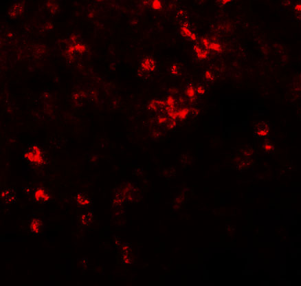 Immunofluorescence of ZIP8 in human spleen tissue with ZIP8 antibody at 20 μg/mL
