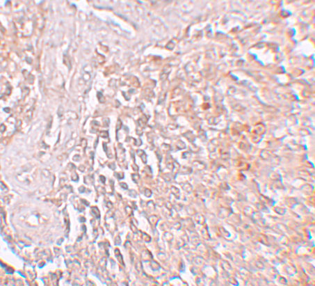 Immunohistochemistry of ZIP8 in human spleen tissue with ZIP8 antibody at 5 μg/mL