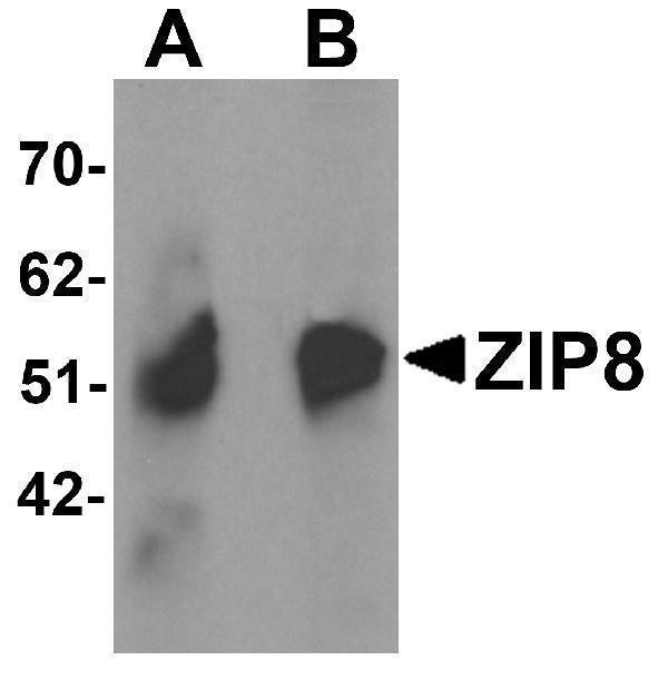 Western blot analysis of ZIP8 in human spleen tissue lysate with ZIP8 antibody at (A) 1 and (B) 2 μg/mL