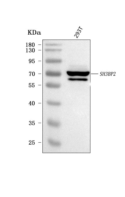  Western blot analysis of 3BP2/SH3BP2 using anti-3BP2/SH3BP2 antibody (A04008-1)