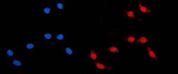 a04010 2 adrm1 primary antibodies if testing 7