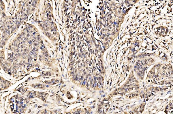  IHC analysis of ADRM1/ARM-1 using anti-ADRM1/ARM-1 antibody (A04010-2)