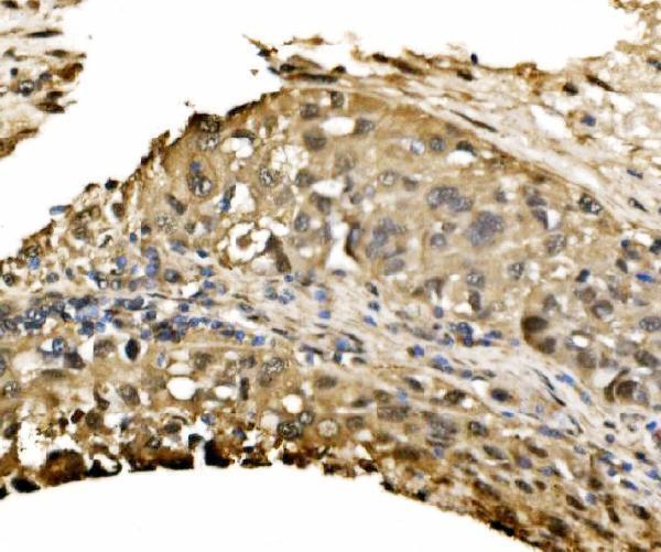  IHC analysis of ADRM1/ARM-1 using anti-ADRM1/ARM-1 antibody (A04010-2)