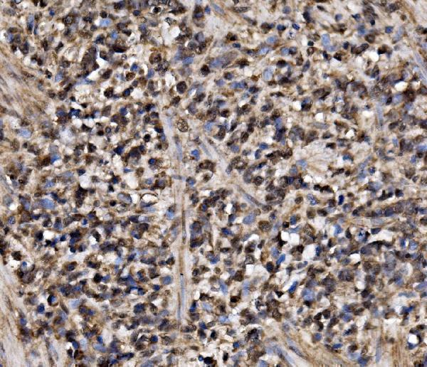 a04010 2 adrm1 primary antibodies ihc testing 4