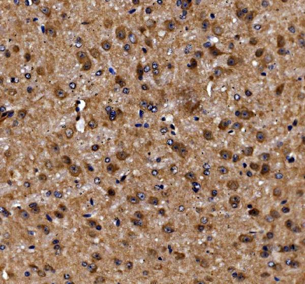 a04010 2 adrm1 primary antibodies ihc testing 5