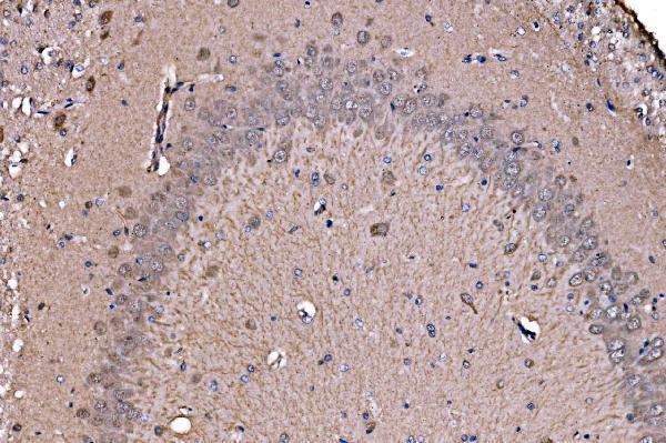 a04010 2 adrm1 primary antibodies ihc testing 6