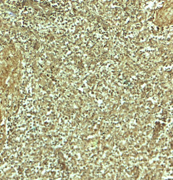 Immunohistochemistry of ADRM1 in human spleen tissue with ADRM1 antibody at 5 μg/mL