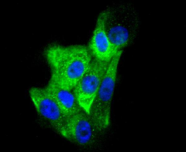 ICC staining Cytokeratin 6 in A431 cells (green)
