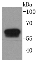 Western blot analysis of Cytokeratin 6 on human skin lysates using anti-Cytokeratin 6 antibody at 1/1,000 dilution